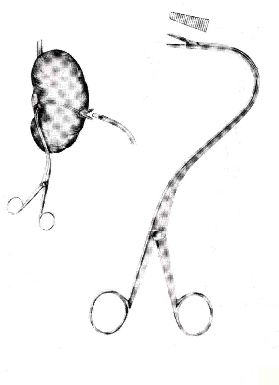 ELSASSER KLEMP 20 CM